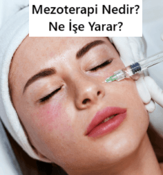 Mezoterapi Nedir? Mezoterapi Nasıl Yapılır?
