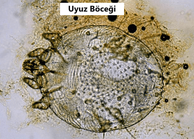 uyuz bocegi