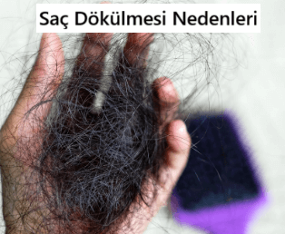 Saç Dökülmesi Neden Olur?