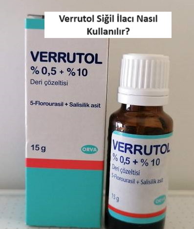 Verrutol Siğil İlacı Nasıl Kullanılır?