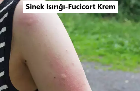 fucicort krem ne işe yarar