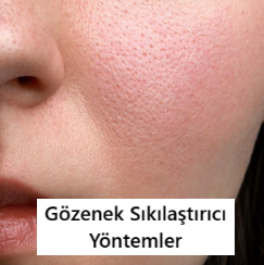 Gözenek: Nedenleri ve Sıkılaştırma Yöntemleri