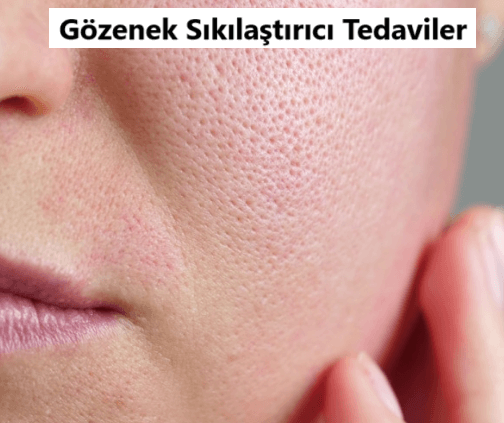 gözenek sıkılaştırıcı serum