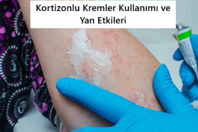 Kortizonlu Kremler: Kullanımı, Yan Etkiler ve Doğru Seçim Rehberi