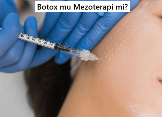 Botoks mu Mezoterapi mi? Hangisi Cildinize Daha Uygun?