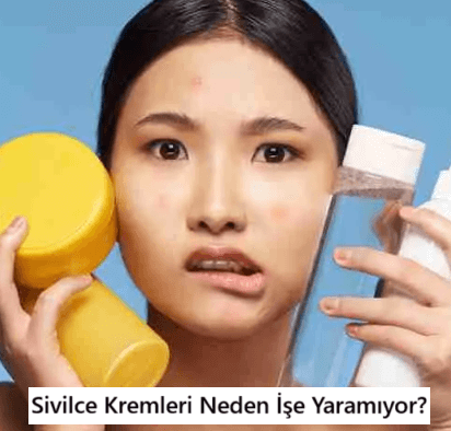 sivilce kremleri işe yarıyor mu