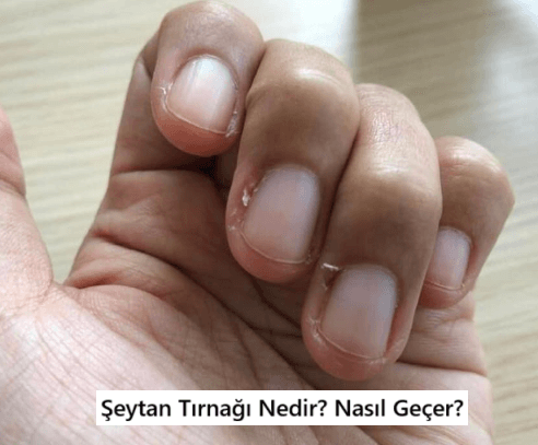 şeytan tırnağı nedir
